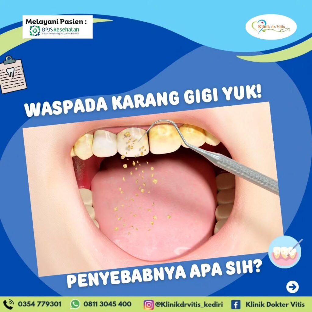 Klinik dr. Vitis, Klinik BPJS Kediri, Klinik 24 Jam Kediri, Klinik BPJS Kediri, Klinik terdekat dari lokasi saya sekarang, klinik buka 24 jam Kediri, cek laboratorium Kediri, Klinik USG Kehamilan Kediri, Klinik rawat inap Kediri, Khitan diKediri, Klinik Pratama Kediri, Klinik Faskes 1 BPJS Kabupaten Kediri, Klinik kesehatan Sembak Grogol Kediri, Klinik rawat inap Kabupaten Kediri, Klinik persalinan 24 jam, tempat bersalin Kabupaten Kediri, Klinik bersalin Kediri, KB Kediri, Pelayanan KB